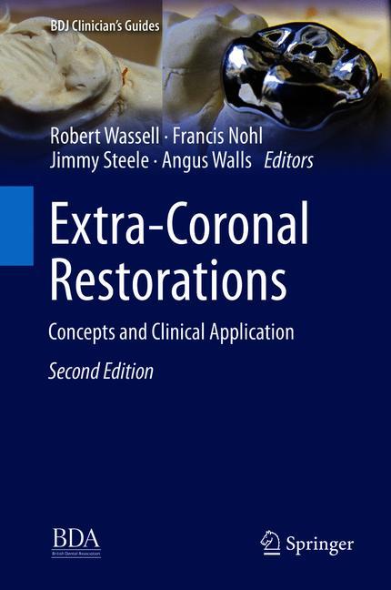 Extra-Coronal Resto…
