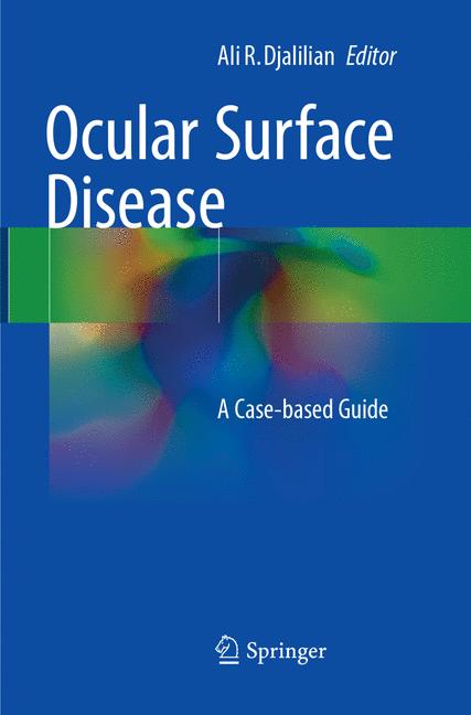 Ocular Surface Dise…