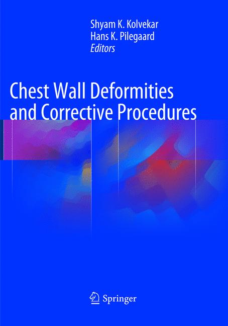Chest Wall Deformit…