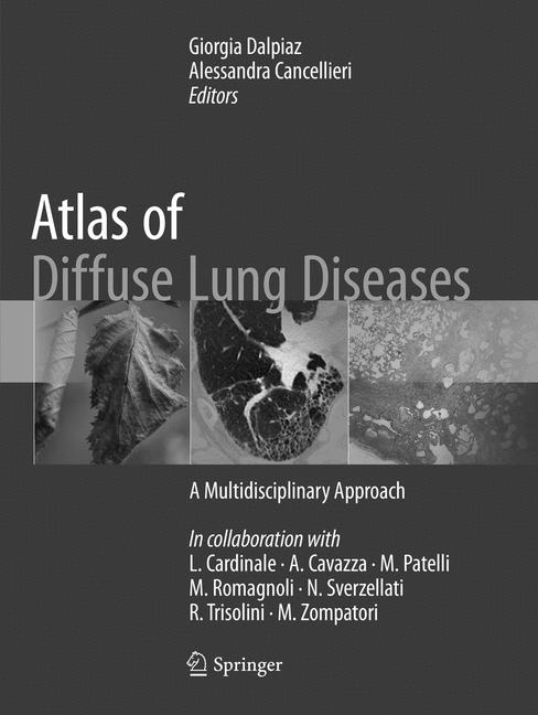 Atlas Of Diffuse Lu…
