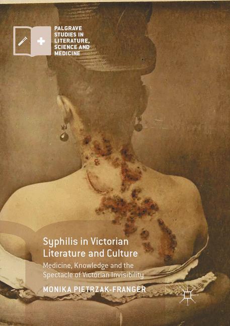 Syphilis In Victori… - image