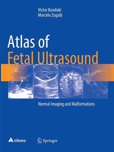 Atlas Of Fetal Ultr… - image