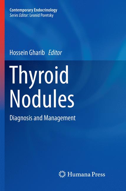 Thyroid Nodules - image