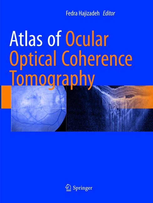 Atlas Of Ocular Opt…