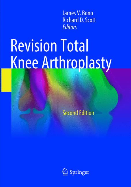 Revision Total Knee… - image