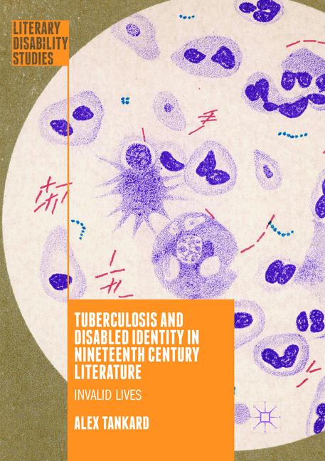 Tuberculosis And Di…