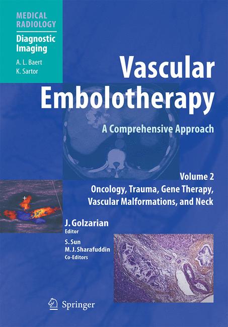 Vascular Embolother…