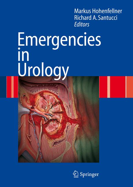 Emergencies In Urol…