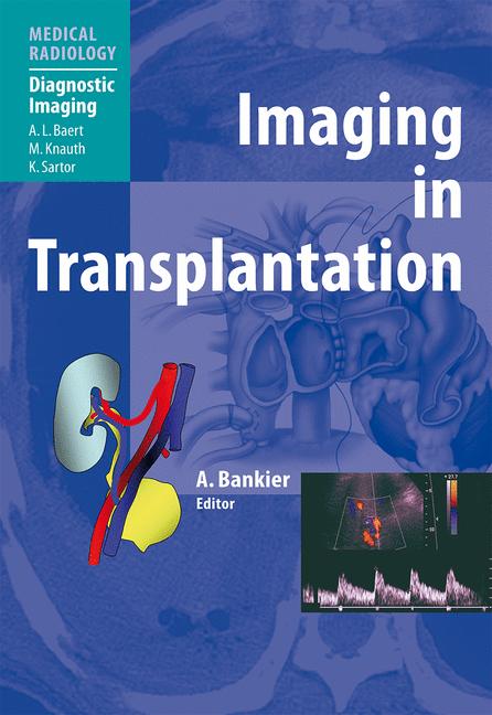 Imaging In Transpla…