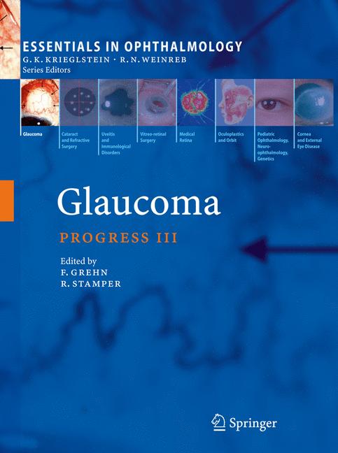 Glaucoma - image