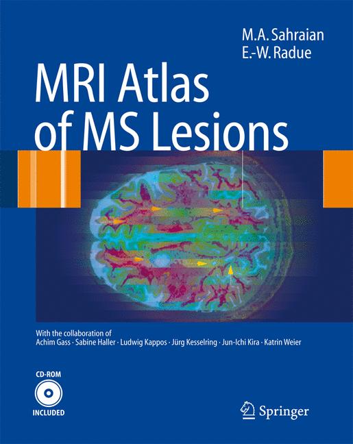 Mri Atlas Of Ms Les… - image