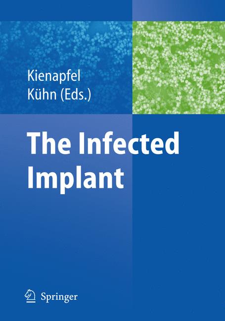 The Infected Implant - image