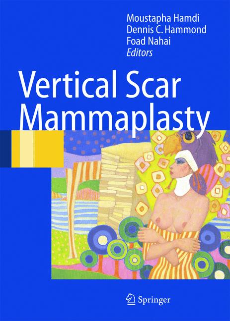 Vertical Scar Mamma…