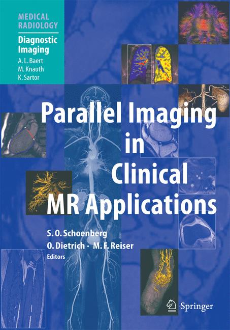 Parallel Imaging In…