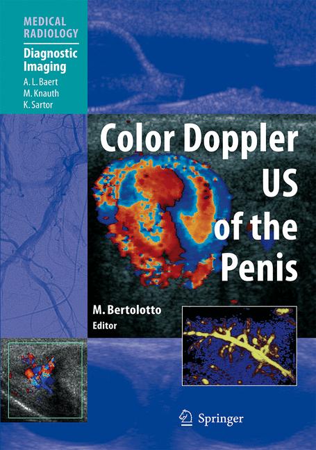 Color Doppler Us Of…