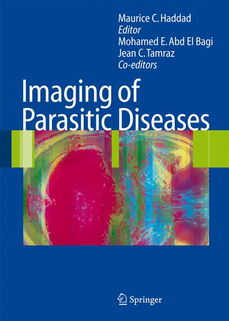 Imaging Of Parasiti… - image