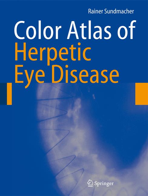 ISBN 9783642088995 product image for Color Atlas of Herpetic Eye Disease | upcitemdb.com