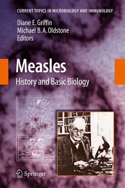 Measles - image