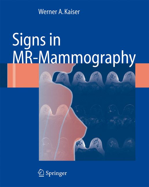 Signs In Mr-Mammogr…