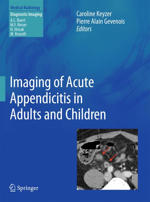 Imaging Of Acute Ap…