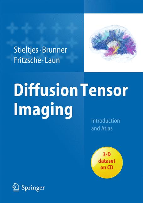 Diffusion Tensor Im…