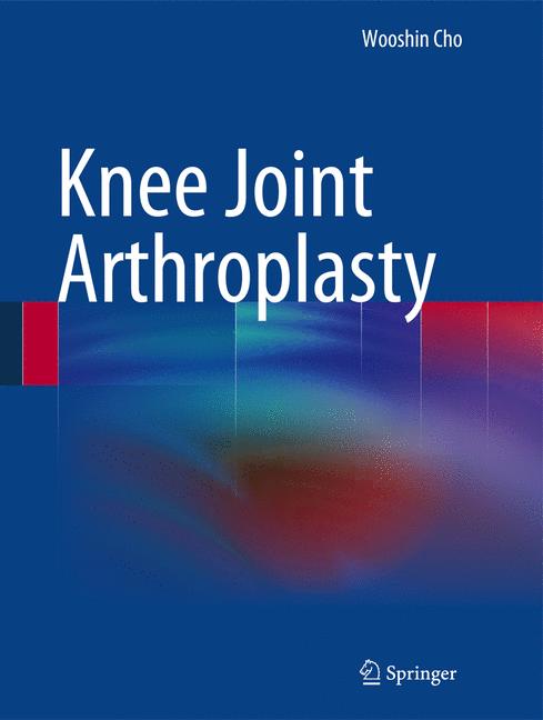Knee Joint Arthropl… - image
