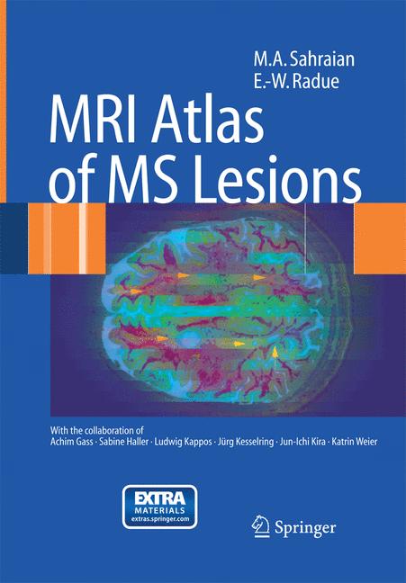 Mri Atlas Of Ms Les… - image