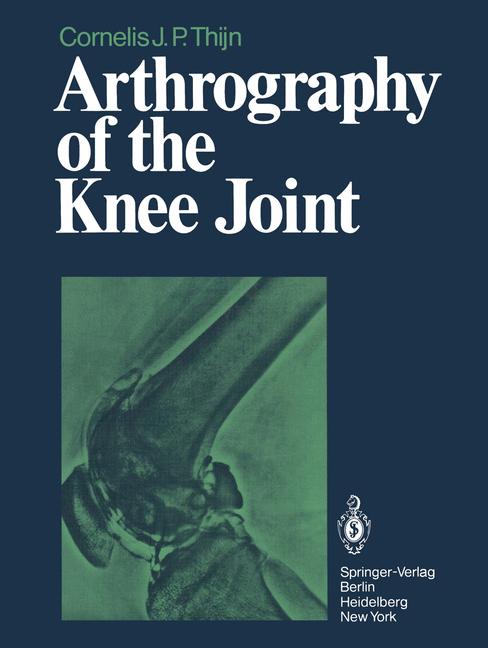 Arthrography Of The… - image