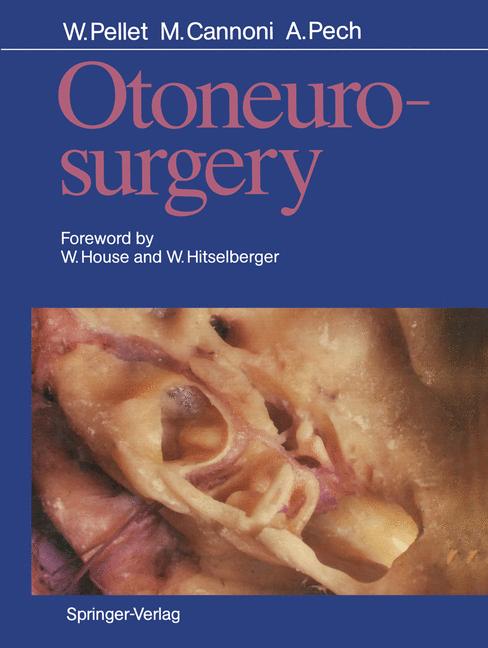 Otoneurosurgery - image