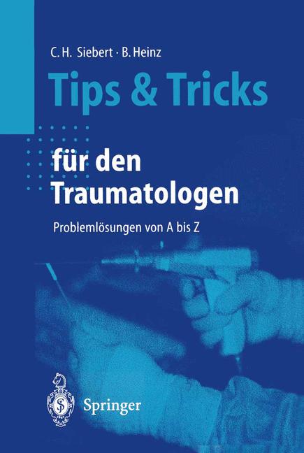 Tips Und Tricks FÃ¼… - image