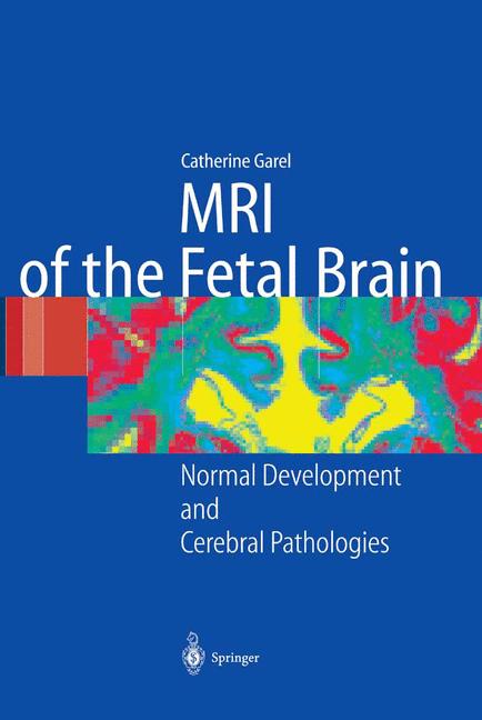 Mri Of The Fetal Br…