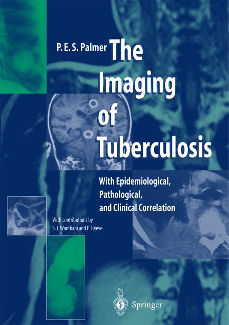 The Imaging Of Tube…