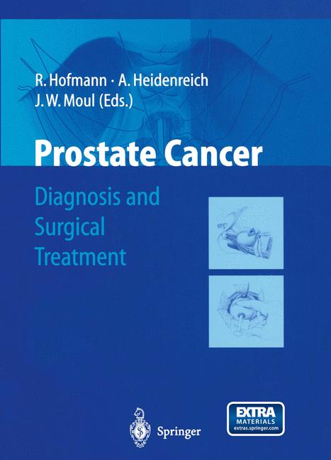 Prostate Cancer - image