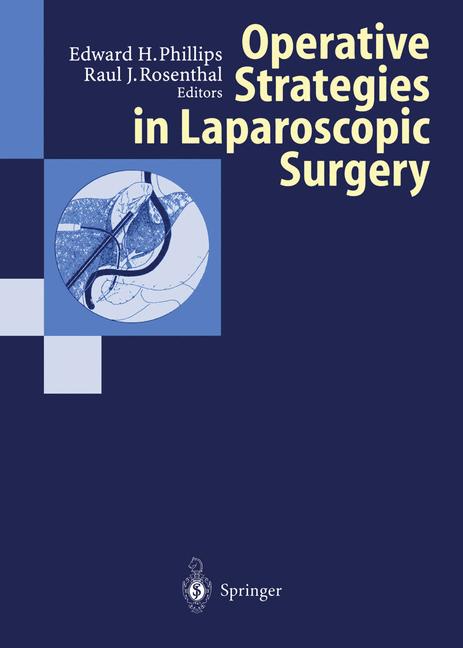 ISBN 9783642633584 product image for Operative Strategies in Laparoscopic Surgery | upcitemdb.com