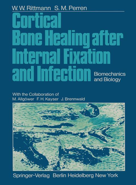 Cortical Bone Heali…