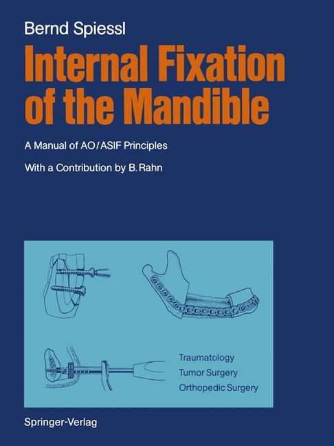 Internal Fixation O…