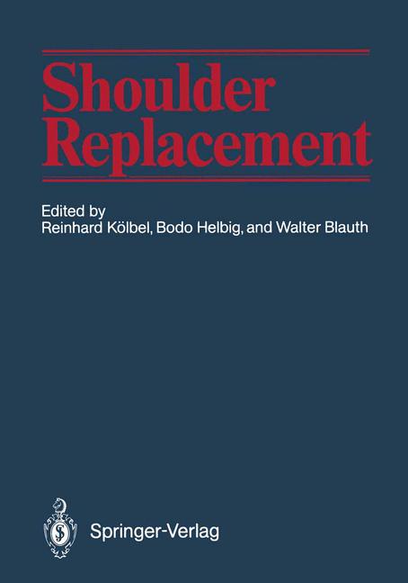 Shoulder Replacement - image
