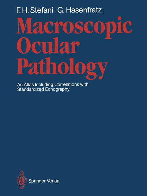Macroscopic Ocular … - image