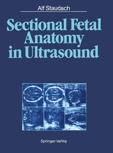 Sectional Fetal Ana…