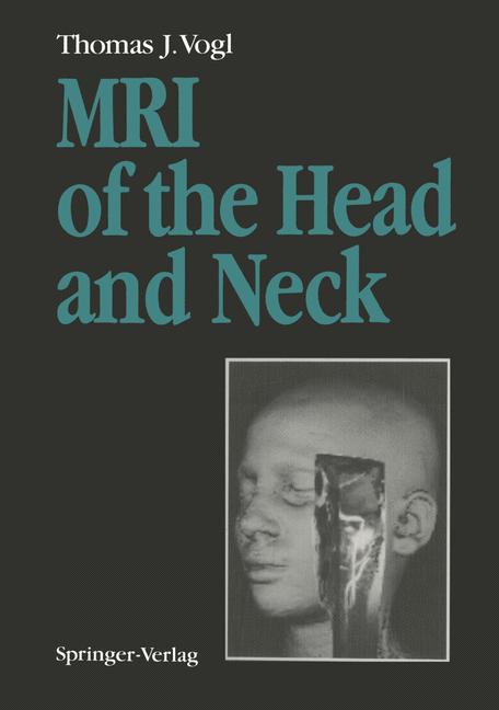 ISBN 9783642767920 product image for MRI of the Head and Neck | upcitemdb.com