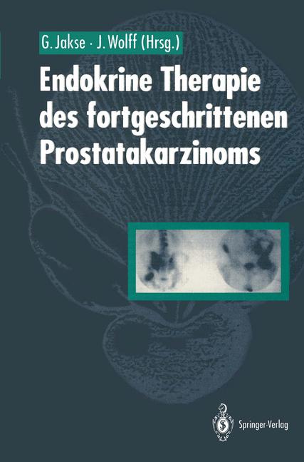ISBN 9783642768675 product image for Endokrine Therapie des fortgeschrittenen Prostatakarzinoms | upcitemdb.com