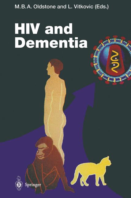 Hiv And Dementia - image