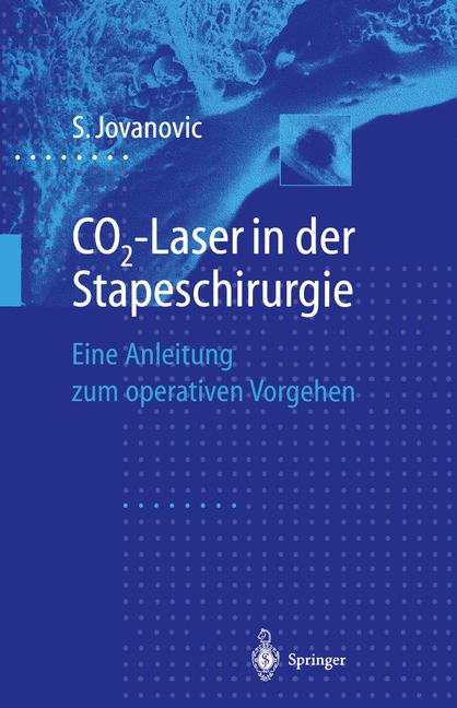 Co2-Laser In Der St…