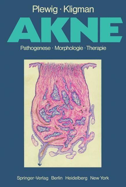 Akne