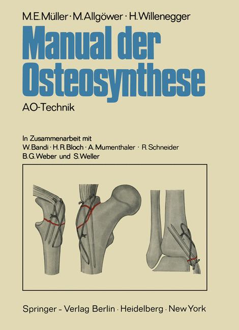 Manual Der Osteosyn…