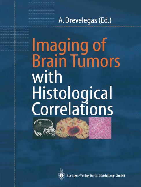 Imaging Of Brain Tu… - image
