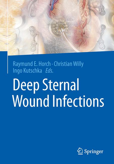 Deep Sternal Wound … - image