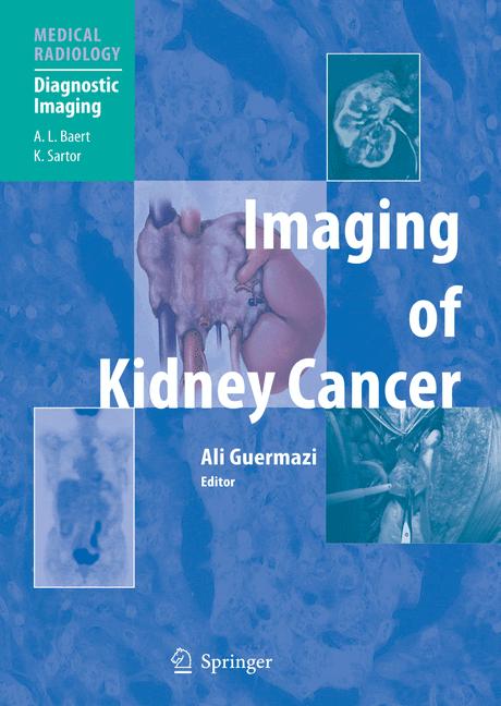 Imaging Of Kidney C…