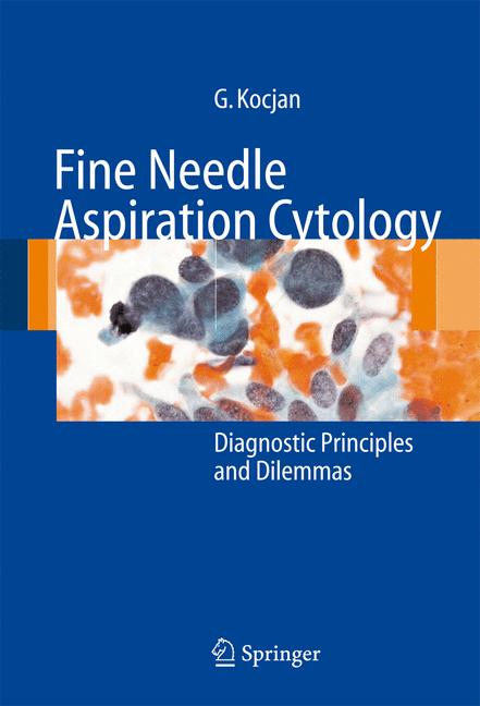 Fine Needle Aspirat… - image