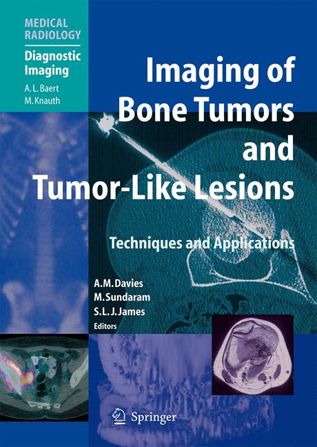 Imaging Of Bone Tum… - image